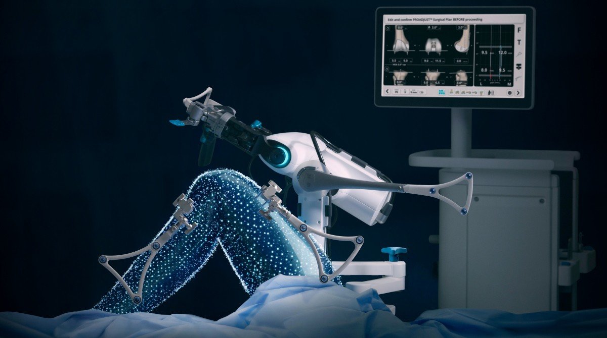 VELYS Robotic-Assisted Solution — robotic arm and PROADJUST surgical planning monitor